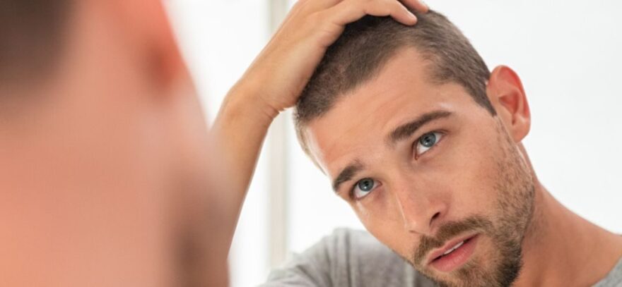 پنج نکته در مورد درمان ام‌اس و ریزش مو