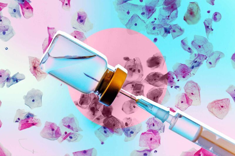 آیا واکسن HPV باعث ابتلا به ام‌اس می‌شود؟